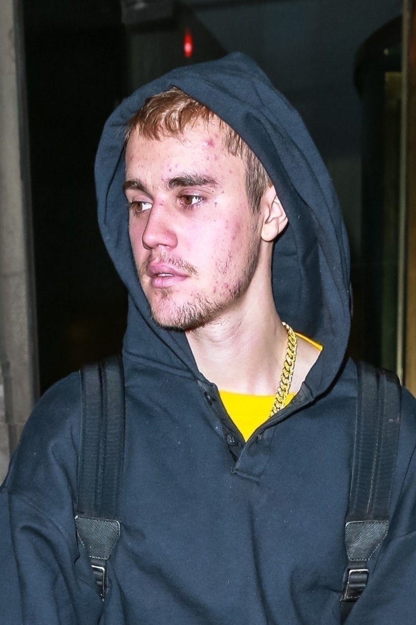 New York, NY  - Justin Bieber is looking bright but casual in a black hoodie and yellow pants as he steps out for a solo stroll in New York. Bieber, who is in town with wife Hailey Baldwin, has admitted that he is struggling with depression and that the couple is attending counseling.

Pictured: Justin Bieber



*UK Clients - Pictures Containing Children
Please Pixelate Face Prior To Publication*, Image: 414388491, License: Rights-managed, Restrictions: , Model Release: no, Credit line: BACKGRID / Backgrid USA / Profimedia